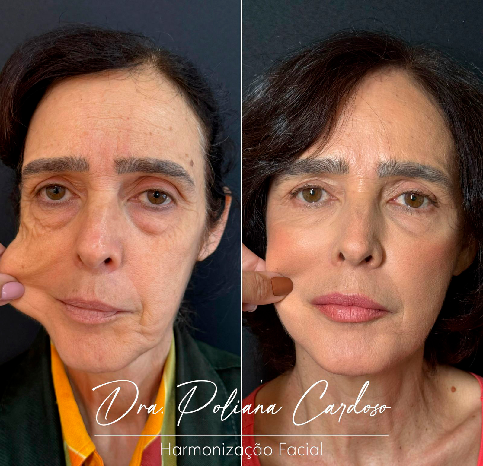 Dra. Poliana Cardoso